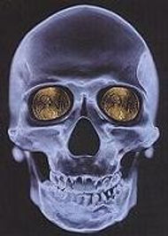 Do catholics put coins in the eyes of the dead? - Answers