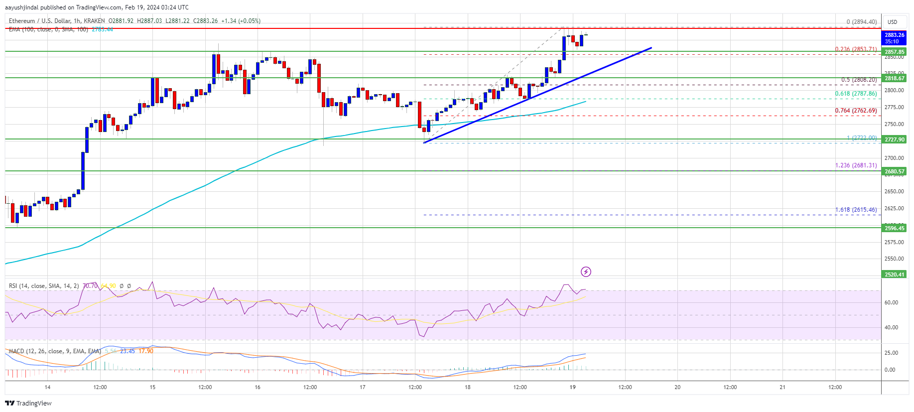 ETHUSD — Ethereum Price Chart — TradingView