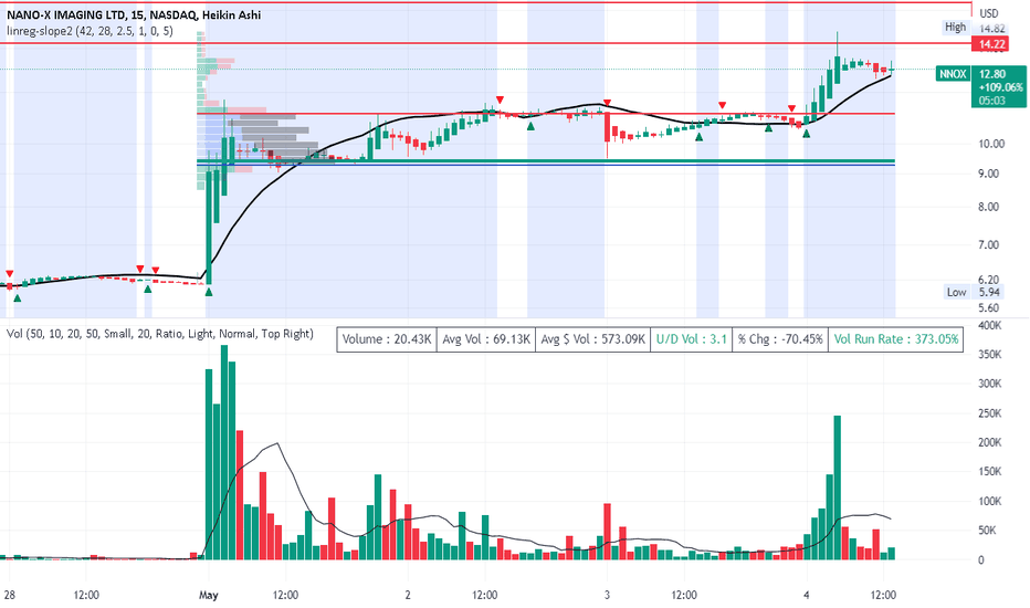 Nano-X Imaging (NNOX) Stock Forecast & Price Prediction , | CoinCodex